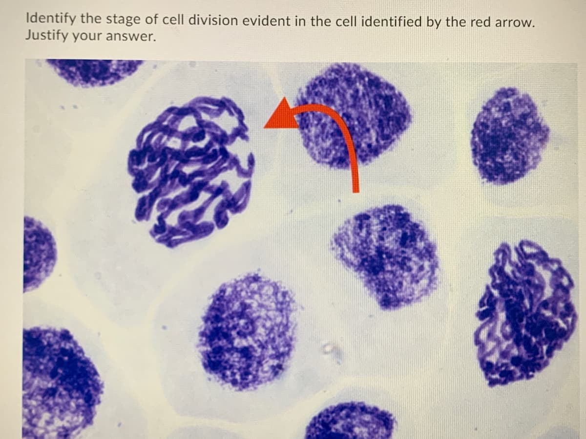 Identify the stage of cell division evident in the cell identified by the red arrow.
Justify your answer.
