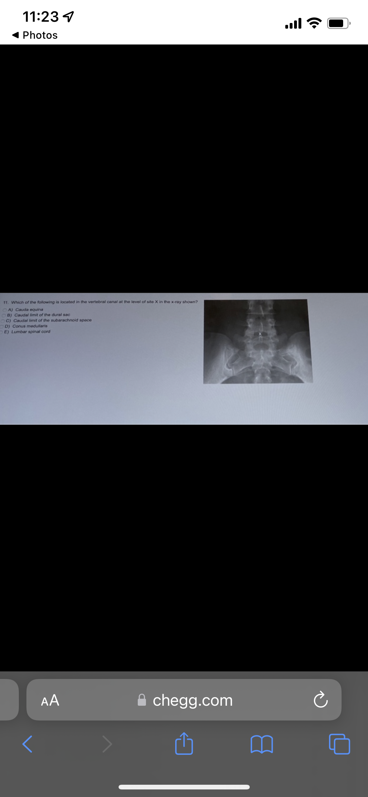 11:23 7
Photos
11. Which of the following is located in the vertebral canal at the level of site X in the x-ray shown?
A) Cauda equina
OB) Caudal limit of the dural sac
C) Caudal limit of the subarachnoid space
D) Conus medullaris
E) Lumbar spinal cord
AA
<
chegg.com
....
