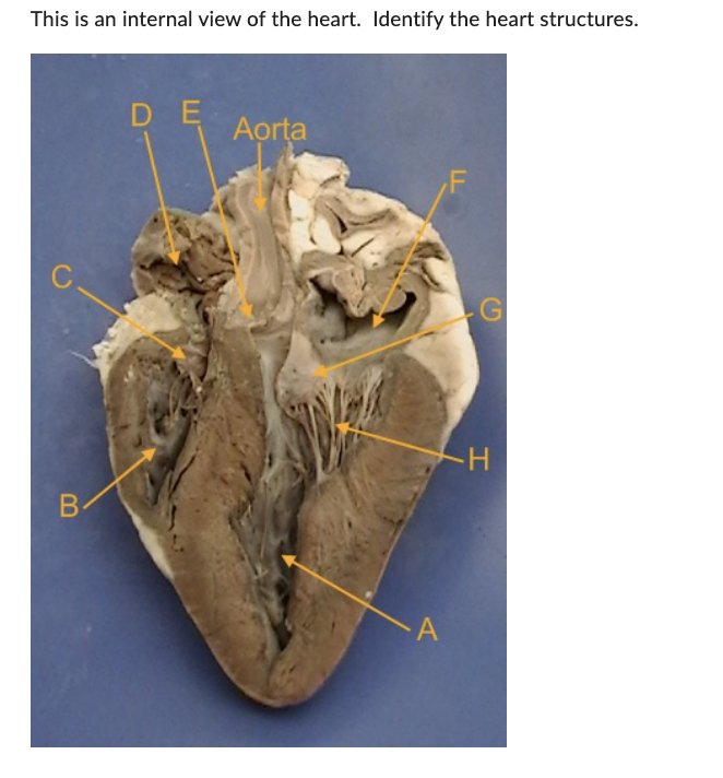 This is an internal view of the heart. Identify the heart structures.
C
B
DE
Aorta
G
I
-H