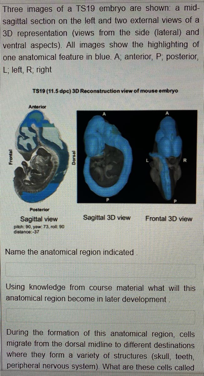 Three images of a TS19 embryo are shown a mid-
sagittal section on the left and two external views of a
3D representation (views from the side (lateral) and
ventral aspects). All images show the highlighting of
one anatomical feature in blue. A; anterior, P, posterior,
L, left, R; right
TS19 (11.5 dpc) 3D Reconstruction view of mouse embryo
Anterior
L
Posterior
Sagittal 3D view
Sagittal view
pitch: 90. yaw: 73. roll: 90
distance:-37
Frontal 3D view
Name the anatomical region indicated
Using knowledge from course material what will this
anatomical region become in later development.
During the formation of this anatomical region, cells
migrate from the dorsal midline to different destinations
where they form a variety of structures (skull, teeth,
peripheral nervous system). What are these cells called
Frontal
