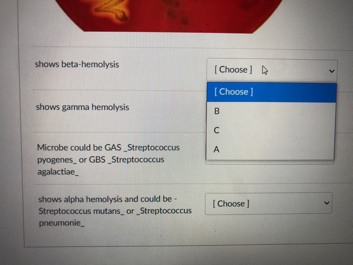 shows beta-hemolysis
[ Choose ]
[Choose ]
shows gamma hemolysis
Microbe could be GAS Streptococcus
A
pyogenes_ or GBS_Streptococcus
agalactiae_
shows alpha hemolysis and could be -
Streptococcus mutans_ or _Streptococcus
pneumonie_
[Choose ]
