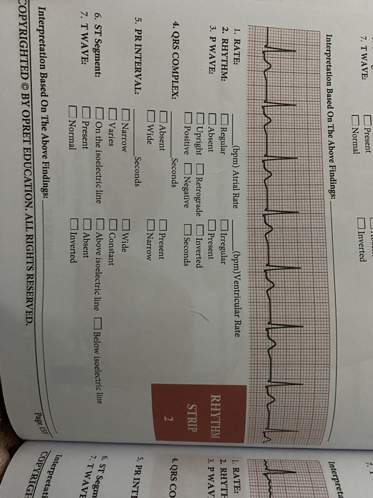7. T WAVE:
Interpretation Based On The Above Findings:
L
1. RATE:
2. RHYTHM:
3. P WAVE:
4. QRS COMPLEX:
5. PR INTERVAL:
Present
Normal
6. ST Segment:
7. T WAVE:
À
(bpm) Atrial Rate
Regular
Absent
سله اللllll
Upright Retrograde
Positive Negative
Absent
Wide
Seconds
Seconds
Inverted
Narrow
Varies
On the isoelectric line
Present
Normal
(bpm)Ventricular Rate
Irregular
Present
Inverted
Seconds
Present
Narrow
Wide
Constant
Above isoelectric line
Absent
Inverted
Interpretation Based On The Above Findings:
COPYRIGHTED BY OPRET EDUCATION. ALL RIGHTS RESERVED.
RHYTHM
STRIP
2
Below isoelectric line
7.
Page 155
Interpreta
1. RATE:
2. RHYTH
3. P WAV
4. QRS CO
5. PRINTE
6. ST Segm
7. TWAVE
Interpretati
COPYRIGH