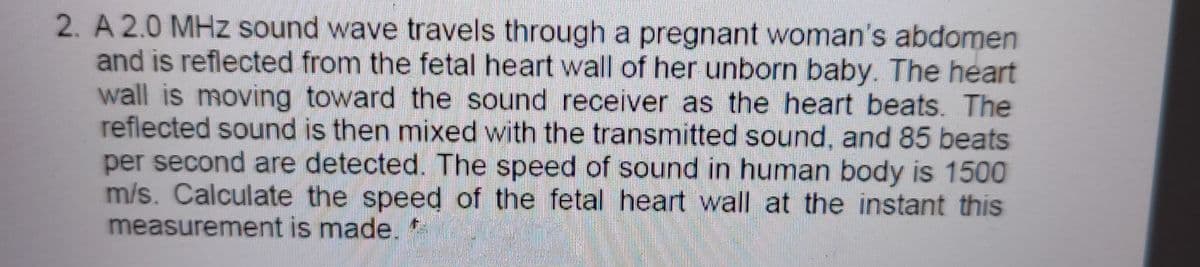 2. A 2.0 MHz sound wave travels through a pregnant woman's abdomen
and is reflected from the fetal heart wall of her unborn baby. The heart
wall is moving toward the sound receiver as the heart beats. The
reflected sound is then mixed with the transmitted sound, and 85 beats
per second are detected. The speed of sound in human body is 1500
m/s. Calculate the speed of the fetal heart wall at the instant this
measurement is made. *
