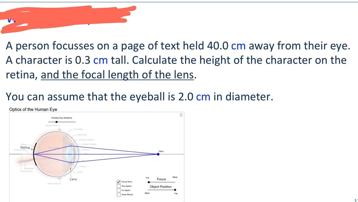 A person focusses on a page of text held 40.0 cm away from their eye.
A character is 0.3 cm tall. Calculate the height of the character on the
retina, and the focal length of the lens.
You can assume that the eyeball is 2.0 cm in diameter.
Optics of the Human Eye
Overlay Eye Anatomy
Retina
Fovea centralis
Optic Nerve
Central retinal v.
Superior rectus m
Ora serrata
Cillary body
Vitreous Bode
Lens
Inferior rectus m
Posterior chamber
Anterior Chamber
Comea
Zonules
Sclera
Object
Far
Near
Focus
Normal Vision
Near Sighted
Object Position
Far Sighted
Near
Needs Bifocals
Far