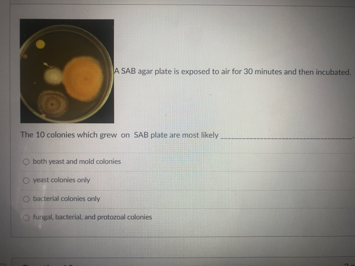 A SAB agar plate is exposed to air for 30 minutes and then incubated.
The 10 colonies which grew on SAB plate are most likely
both yeast and mold colonies
yeast colonies only
bacterial colonies only
fungal, bacterial, and protozoal colonies

