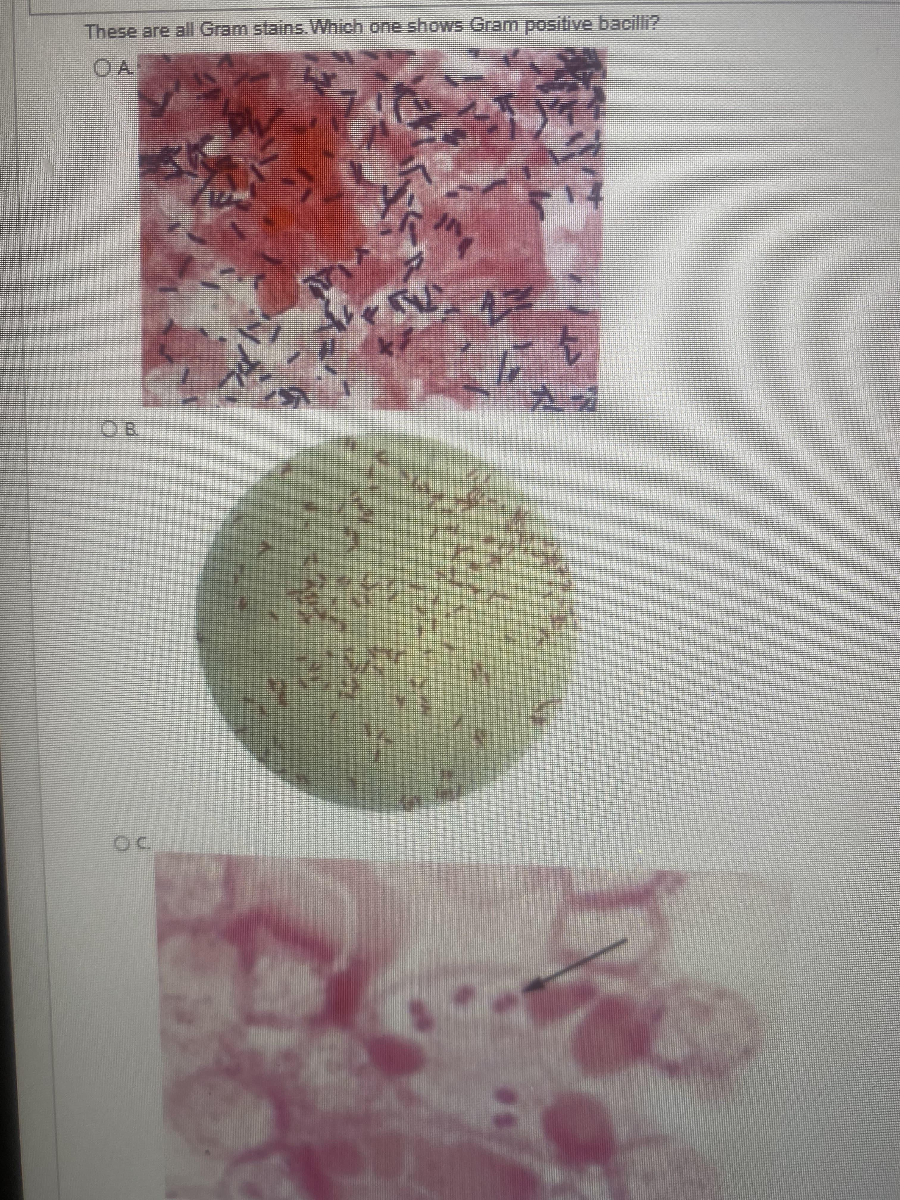 These are all Gram stains. Which one shows Gram positive bacilli2
OA
OB
