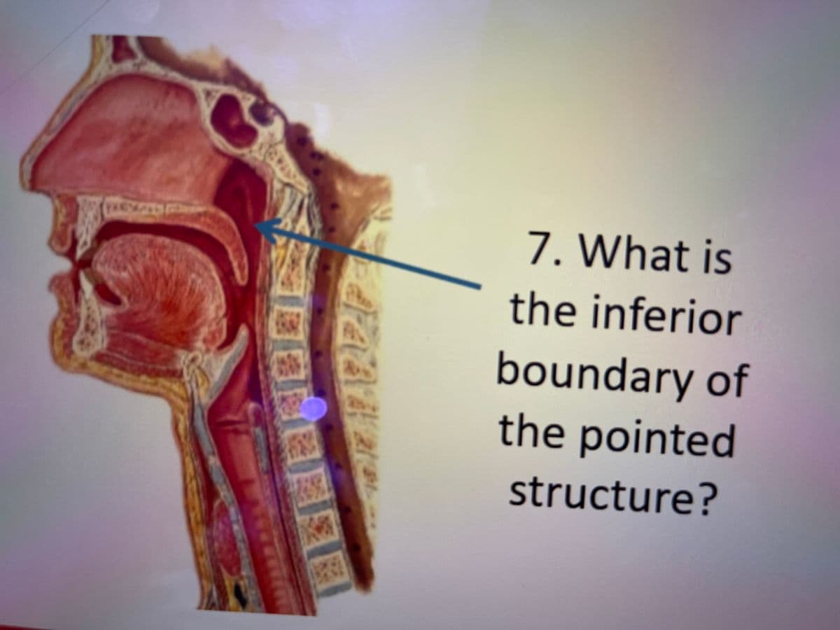 7. What is
the inferior
boundary of
the pointed
structure?
