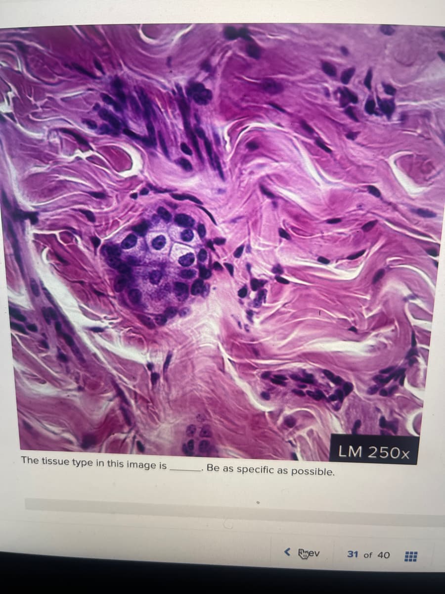 The tissue type in this image is
Be as specific as possible.
< Fev
LM 250x
31 of 40 -
