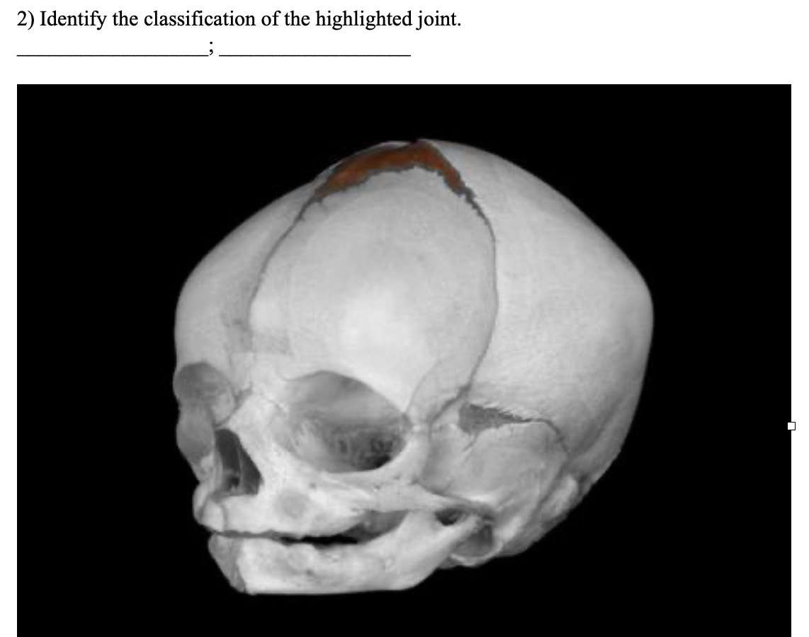 2) Identify the classification of the highlighted joint.
☐