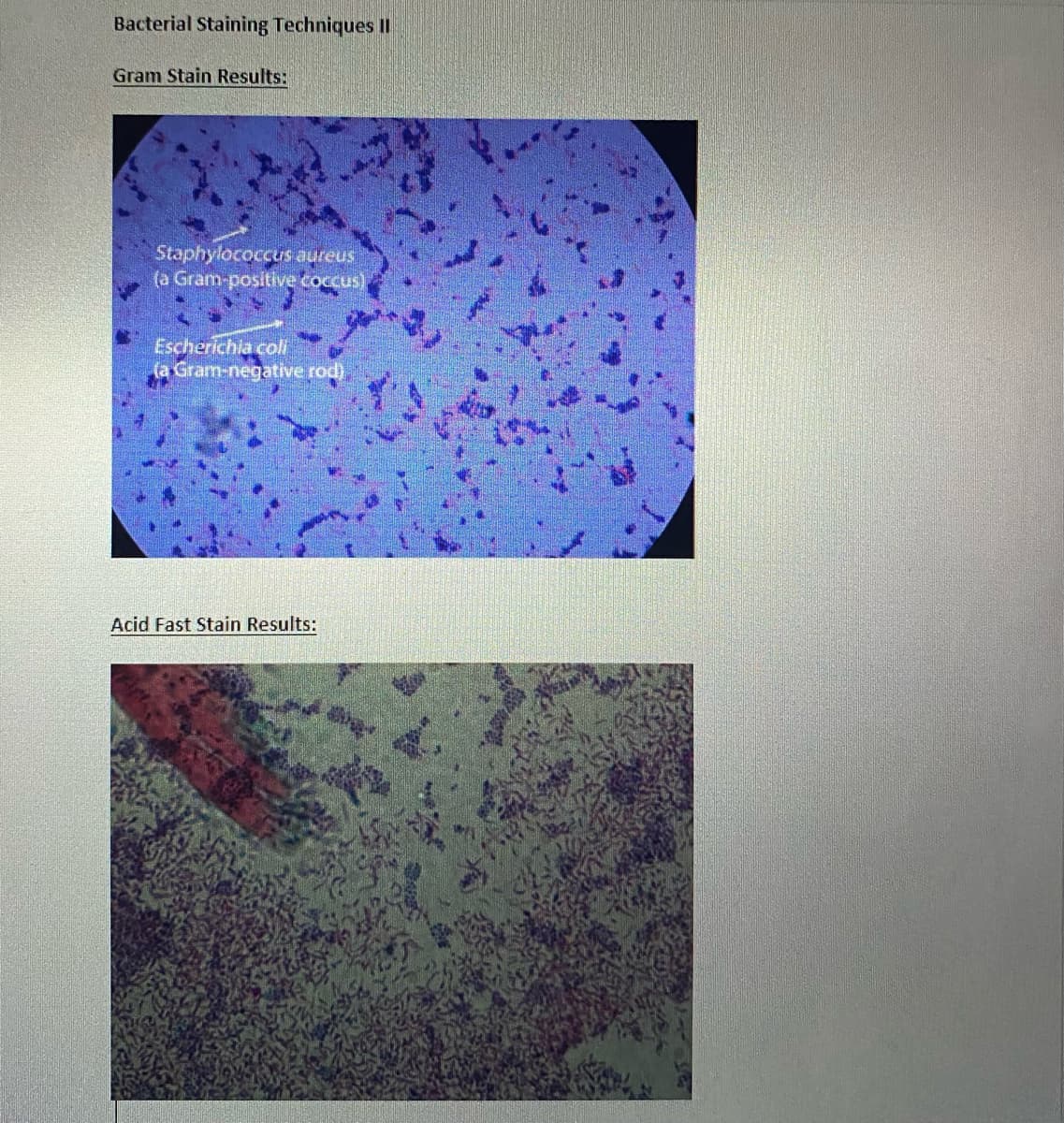 Bacterial Staining Techniques iI
Gram Stain Results:
Staphylococcus aureus
(a Gram-positive coccus)
Escherichia coli
(a Gram-negative rod)
Acid Fast Stain Results:
