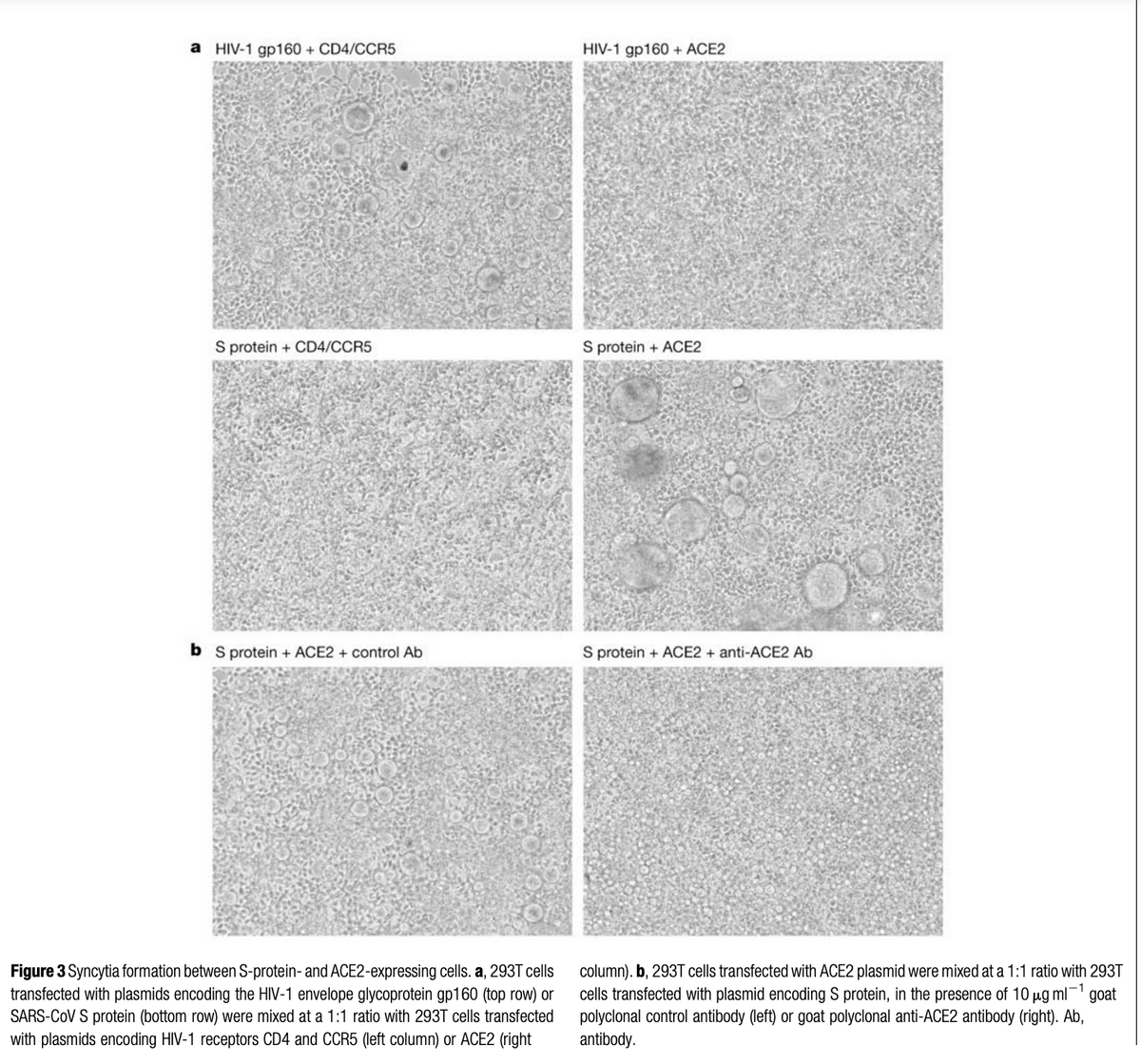 a HIV-1 gp160 + CD4/CCR5
S protein + CD4/CCR5
b S protein + ACE2 + control Ab
Figure 3 Syncytia formation between S-protein- and ACE2-expressing cells. a, 293T cells
transfected with plasmids encoding the HIV-1 envelope glycoprotein gp160 (top row) or
SARS-CoV S protein (bottom row) were mixed at a 1:1 ratio with 293T cells transfected
with plasmids encoding HIV-1 receptors CD4 and CCR5 (left column) or ACE2 (right
HIV-1 gp160 + ACE2
S protein + ACE2
S protein + ACE2 + anti-ACE2 Ab
column). b, 293T cells transfected with ACE2 plasmid were mixed at a 1:1 ratio with 293T
cells transfected with plasmid encoding S protein, in the presence of 10 μg ml-1 goat
polyclonal control antibody (left) or goat polyclonal anti-ACE2 antibody (right). Ab,
antibody.