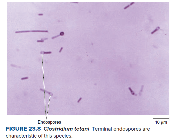 Endospores
10 μη
FIGURE 23.8 Clostridium tetani Terminal endospores are
characteristic of this species.

