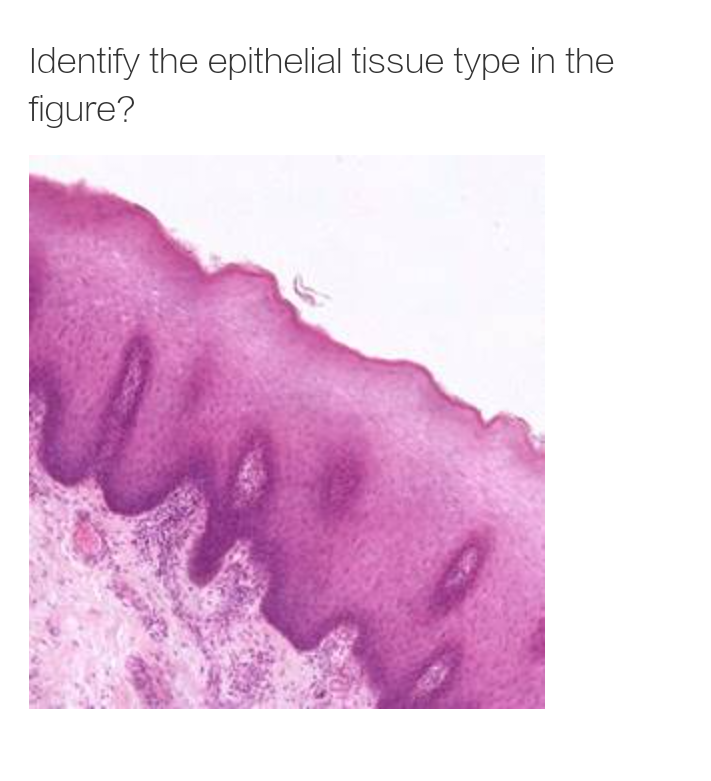 Identify the epithelial tissue type in the
figure?
