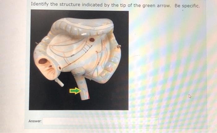 Identify the structure indicated by the tip of the green arrow. Be specific.
Answer: