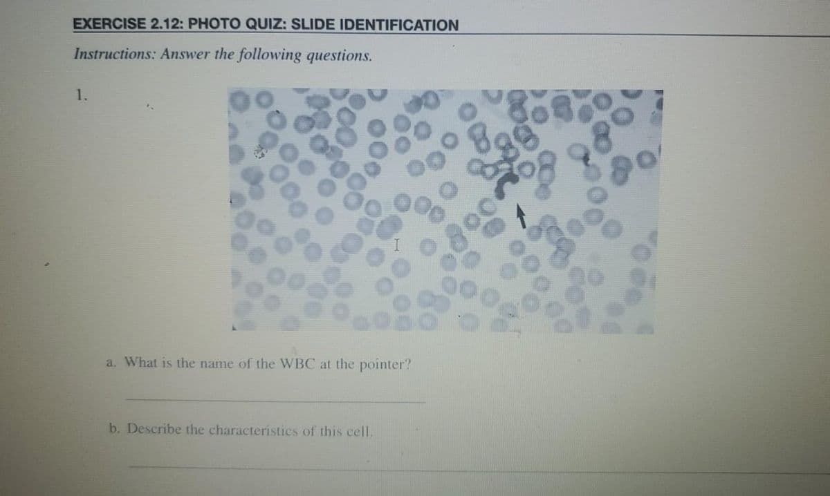 EXERCISE 2.12: PHOTO QUIZ: SLIDE IDENTIFICATION
Instructions: Answer the following questions.
1.
a. What is the name of the WBC at the pointer?
b. Describe the characteristics of this cell.