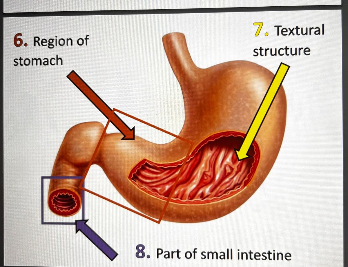 6. Region of
stomach
7. Textural
structure
8. Part of small intestine