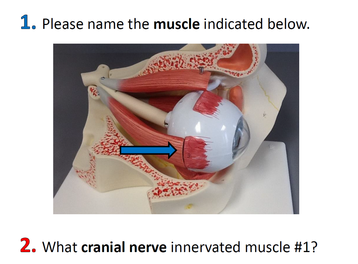 1. Please name the muscle indicated below.
2. What cranial nerve innervated muscle #1?