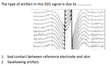 The type of artifact in this EEG signal is due to
1. bad contact between reference electrode and skin.
2. Swallowing artifact.
