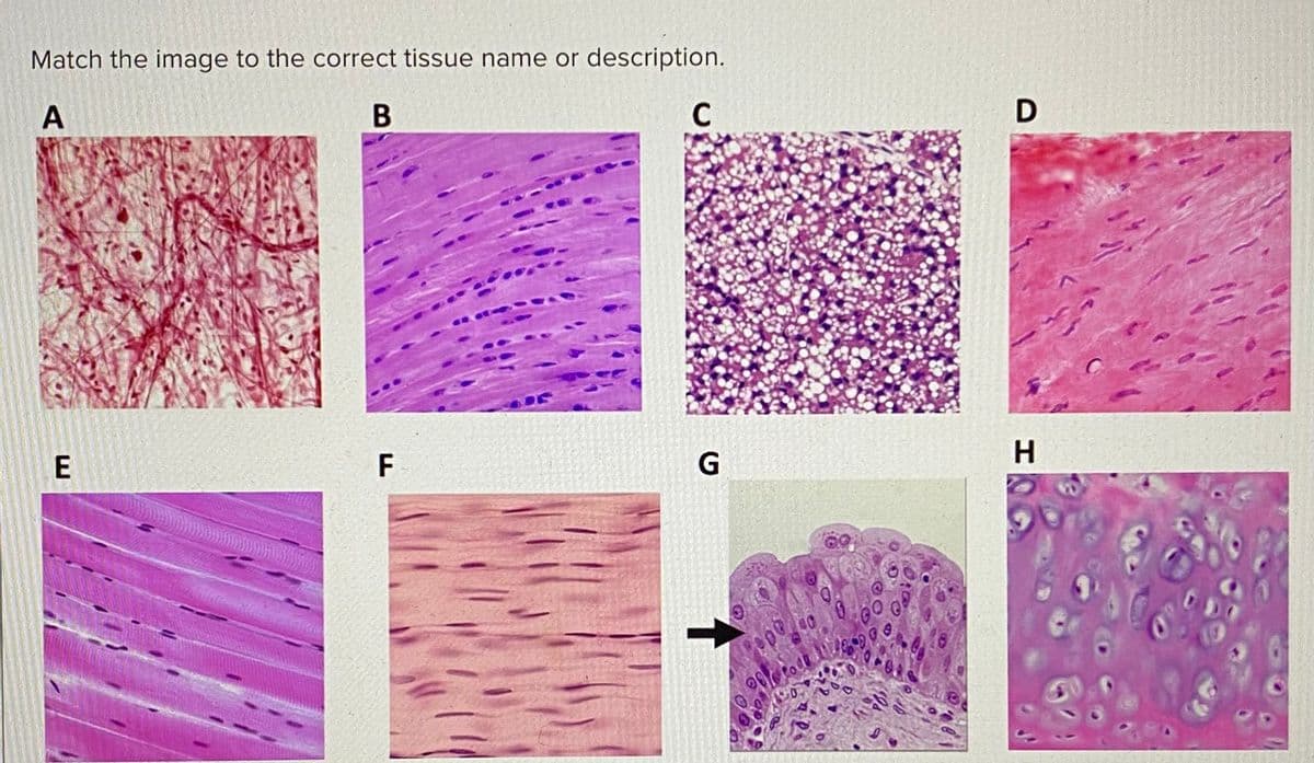 Match the image to the correct tissue name or description.
A
B
F
C
G
GO
D