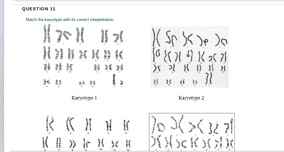 QUESTION 11
Match the karyotype with its correct interpretation.
Karyotype 1
Karyotype 2
3
10
11
12
