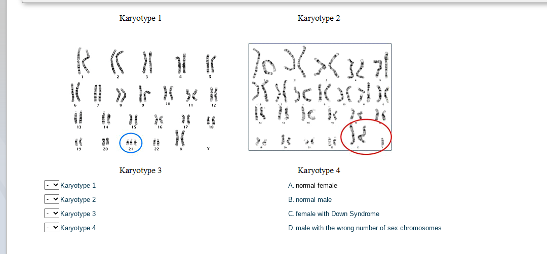 Karyotype 1
Karyotype 2
3
9
10
11
13
14
16
17
19
20
21
22
Karyotype 3
Karyotype 4
Karyotype 1
|- v Karyotype 2
- vKaryotype 3
A. normal female
B. normal male
C. female with Down Syndrome
- Karyotype 4
D. male with the wrong number of sex chromosomes
