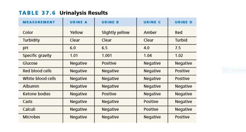 TABLE 37.6 Urinalysis Results
MEASUREMENT
URINE A
URINE B
URINE C
URINE D
Color
Yellow
Slightly yellow
Amber
Red
Turbidity
Clear
Clear
Clear
Turbid
pH
6.0
6.5
4.0
7.5
Specific gravity
1.01
1.001
1.04
1.02
Glucose
Negative
Positive
Negative
Negative
Red blood cells
Negative
Negative
Negative
Positive
Rectang
White blood cells
Negative
Negative
Negative
Positive
Albumin
Negative
Negative
Negative
Negative
Ketone bodies
Negative
Positive
Negative
Negative
Casts
Negative
Negative
Positive
Negative
Calculi
Negative
Negative
Positive
Negative
Microbes
Negative
Negative
Negative
Positive
