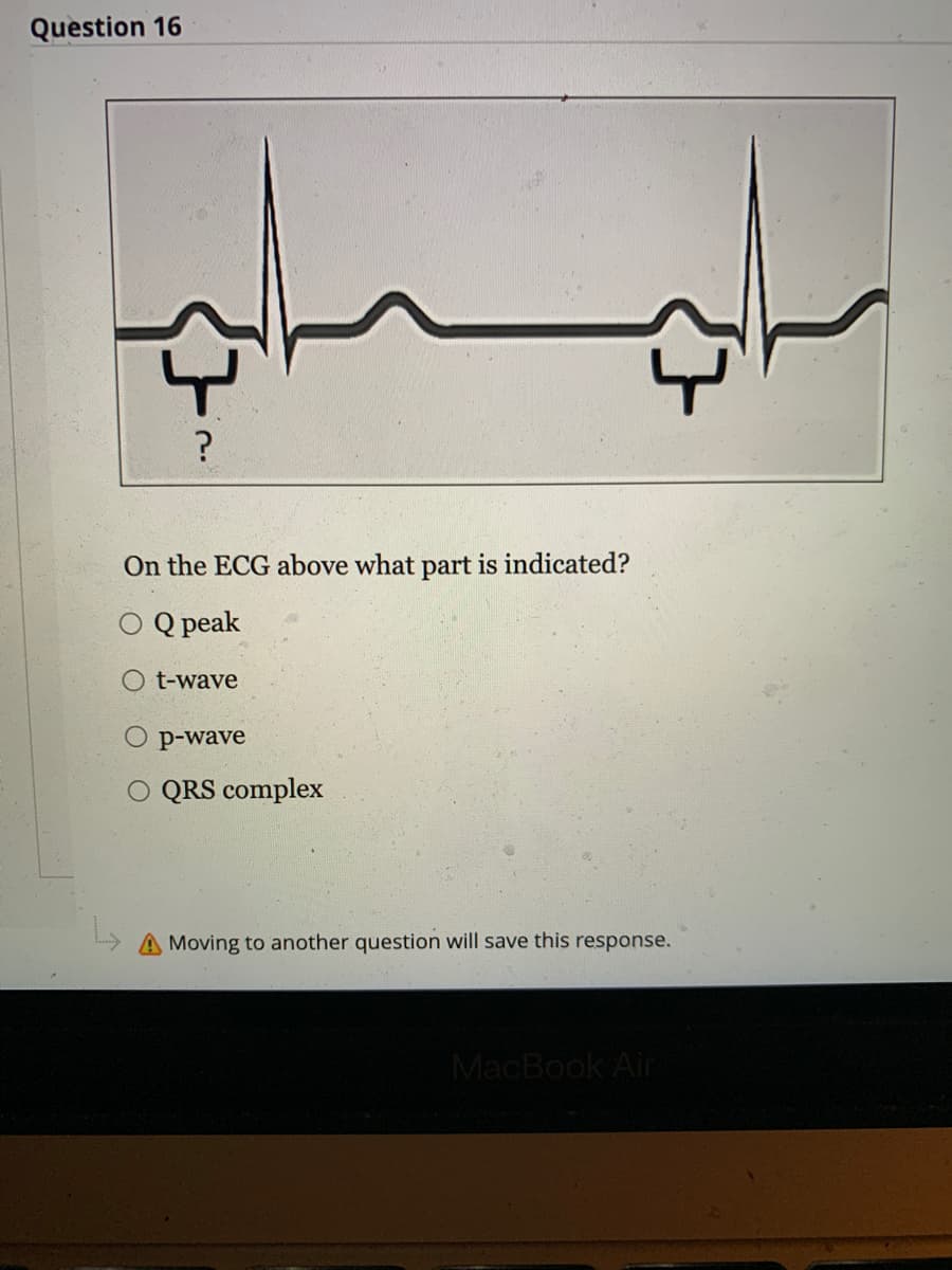 Question 16
?
On the ECG above what part is indicated?
Q peak
t-wave
p-wave
QRS complex
A Moving to another question will save this response.
MacBook Air