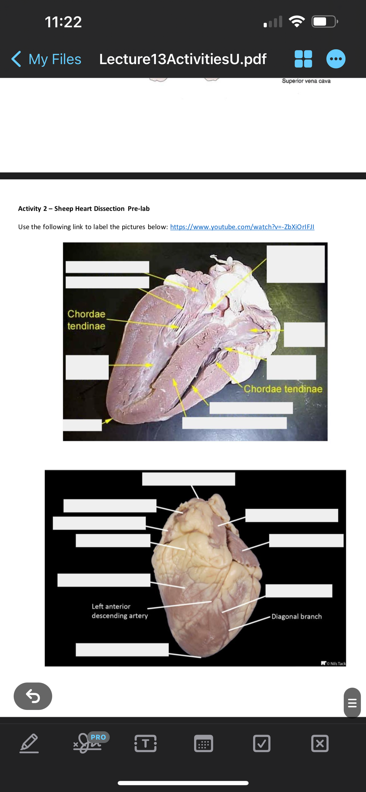 <
11:22
My Files Lecture13Activities U.pdf
Superior vena cava
Activity 2 Sheep Heart Dissection Pre-lab
Use the following link to label the pictures below: https://www.youtube.com/watch?v=-ZbXiOrlFJI
←
Chordae
tendinae
Chordae tendinae
Left anterior
descending artery
Diagonal branch
PRO
☑
☑
Nils Tack
|||