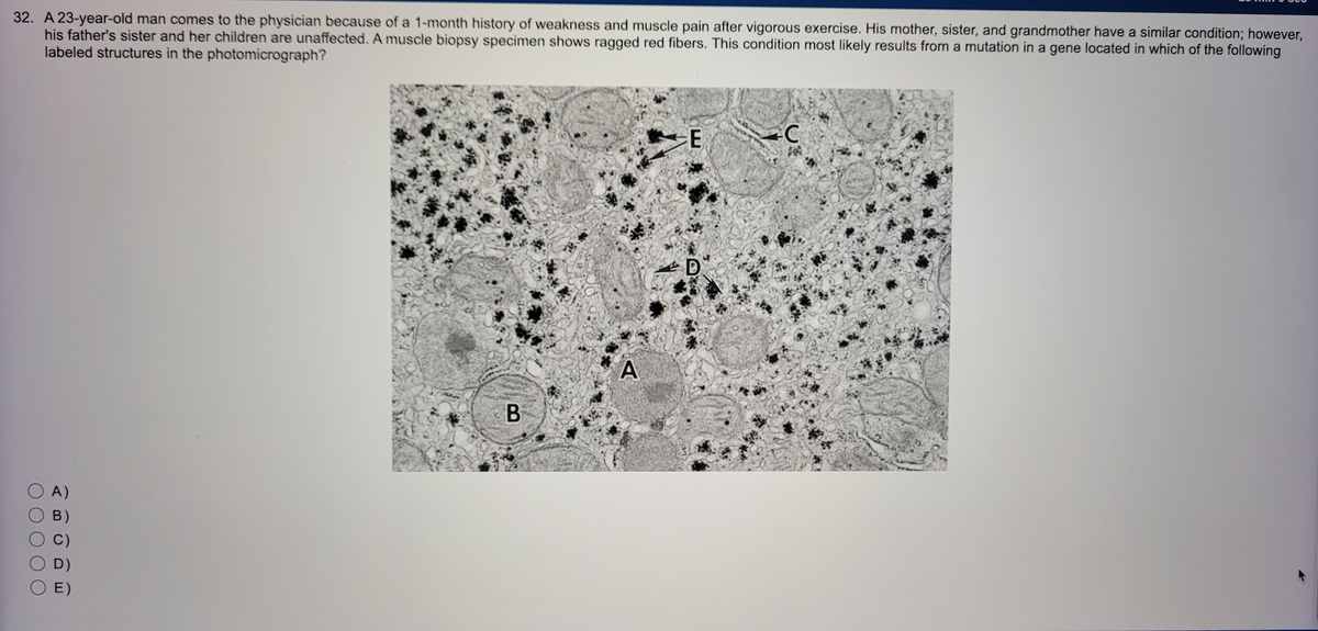 32. A 23-year-old man comes to the physician because of a 1-month history of weakness and muscle pain after vigorous exercise. His mother, sister, and grandmother have a similar condition; however,
his father's sister and her children are unaffected. A muscle biopsy specimen shows ragged red fibers. This condition most likely results from a mutation in a gene located in which of the following
labeled structures in the photomicrograph?
00
O O
A)
B)
E)
B
A
E
D
C
AR