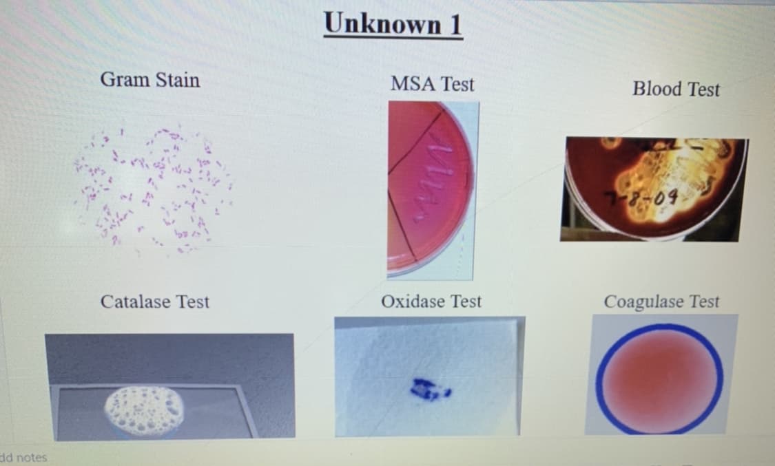 Unknown 1
Gram Stain
MSA Test
Blood Test
Catalase Test
Oxidase Test
Coagulase Test
dd notes
