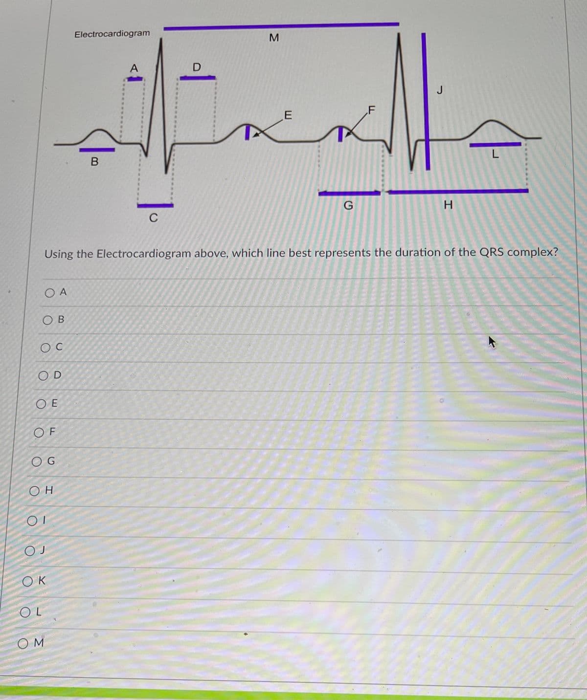Electrocardiogram
D
J
.F
C
H.
Using the Electrocardiogram above, which line best represents the duration of the QRS complex?
O A
OB
OD
O E
OF
O G
OK
OL
O M

