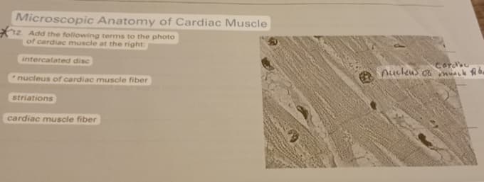 Microscopic Anatomy of Cardiac Muscle
12. Add the following terms to the photo
of cardiac muscle at the right:
intercalated disc
nucleus of cardiac muscle fiber
striations
cardiac muscle fiber
Cordial
nucleus of musik fibe