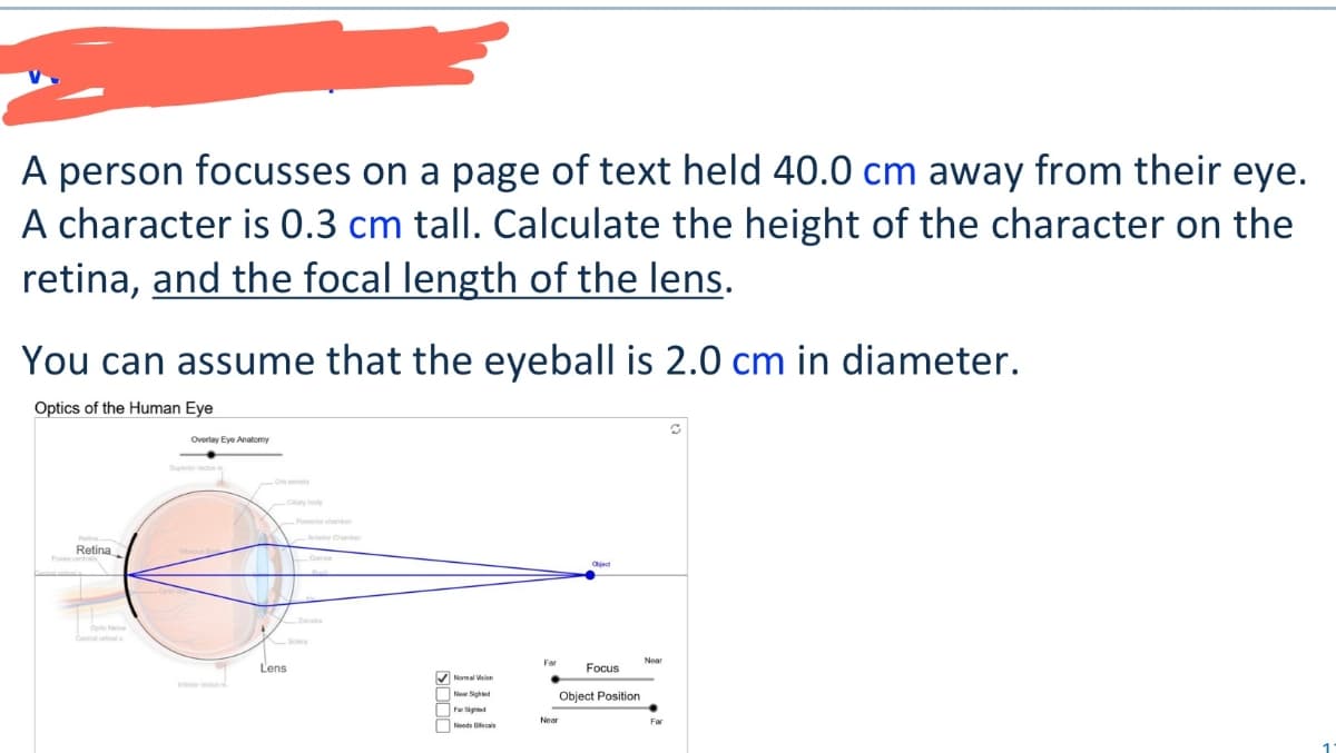 A person focusses on a page of text held 40.0 cm away from their eye.
A character is 0.3 cm tall. Calculate the height of the character on the
retina, and the focal length of the lens.
You can assume that the eyeball is 2.0 cm in diameter.
Optics of the Human Eye
Overlay Eye Anatomy
Retina
Inferior rectus m
Lens
Posterior chamber
Anterior Chamber
Zonales
Near Sighted
Far Sighted
Noods Bals
Chied
Far
Neat
Focus
Near
Object Position