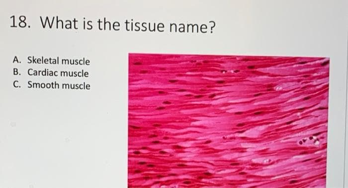 18. What is the tissue name?
A. Skeletal muscle
B. Cardiac muscle
C. Smooth muscle
