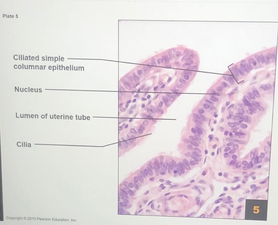 Plate 5
Ciliated simple
columnar epithelium
Nucleus
Lumen of uterine tube
Cilia
Copyright © 2010 Pearson Education, Inc.
