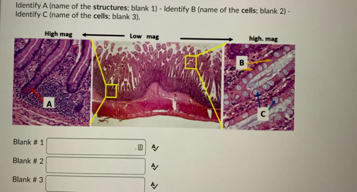 Identify A (name of the structures; blank 1) - ldentify B (name of the cells; blank 2) -
Identify C (name of the cells; blank 3).
High mag
Low mag
high. mag
A
Blank # 1
Blank # 2
Blank # 3
