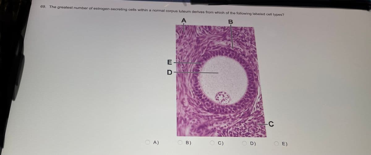 69. The greatest number of estrogen-secreting cells within a normal corpus luteum derives from which of the following labeled cell types?
A
B
OA)
ED
B)
C)
D)
C
E)