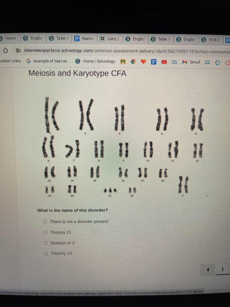 S Home
S Englis
S Ta kei 8
E Nama
E Lists, L
S Englis
S Takei &
S Englis
S 10-BC
合
b lakeviewspartans.schoology.com/common-assessment-delivery/start/5607459174?action=Donresume
udent Links
G example of heat en..
S Home| Schoology B
M Gmail
Esco
Meiosis and Karyotype CFA
I1 0 8
%3D
14
What is the name of this disorder?
O There is not a disorder present
O Trisomy 21
O Deletion of Y
O Trisomy 13
1
eviewspartans schoology.com/common a ssessment-delivery/start/5607459174?a ction=onresume&submissionld-771973820#
