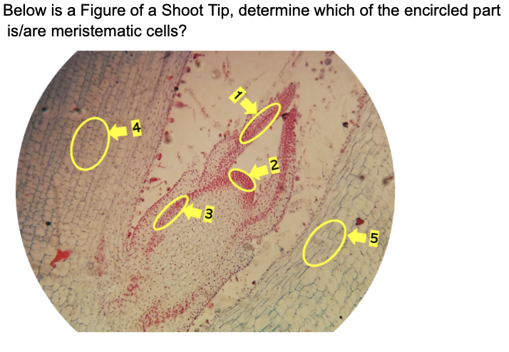 Below is a Figure of a Shoot Tip, determine which of the encircled part
is/are meristematic cells?
4
5
