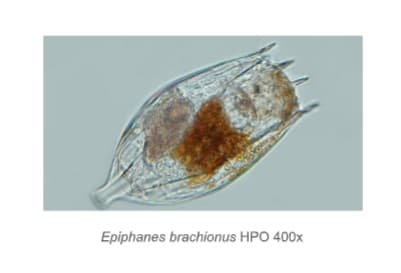 Epiphanes brachionus HPO 400x
