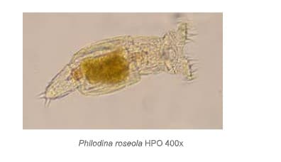 Philodina roseola HPO 400x
