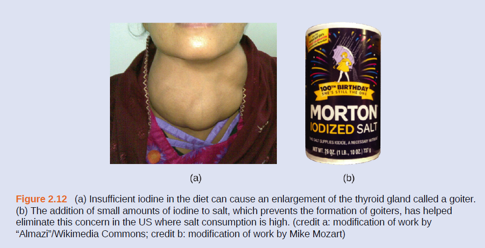 100H BIRTHDAY
SHE'S STILL THE ONI
MORTON
IODIZED SALT
U SUPPLIES IODIDE, A NECESSA
MET WT. 26 QZ. (1 LB., 10 0Z.) 737 4
(a)
(b)
Figure 2.12 (a) Insufficient iodine in the diet can cause an enlargement of the thyroid gland called a goiter.
(b) The addition of small amounts of iodine to salt, which prevents the formation of goiters, has helped
eliminate this concern in the US where salt consumption is high. (credit a: modification of work by
"Almazi"/Wikimedia Commons; credit b: modification of work by Mike Mozart)
