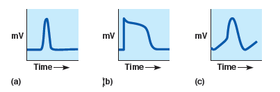 mv
Time
Time -
Time
(a)
[b)
(c)
