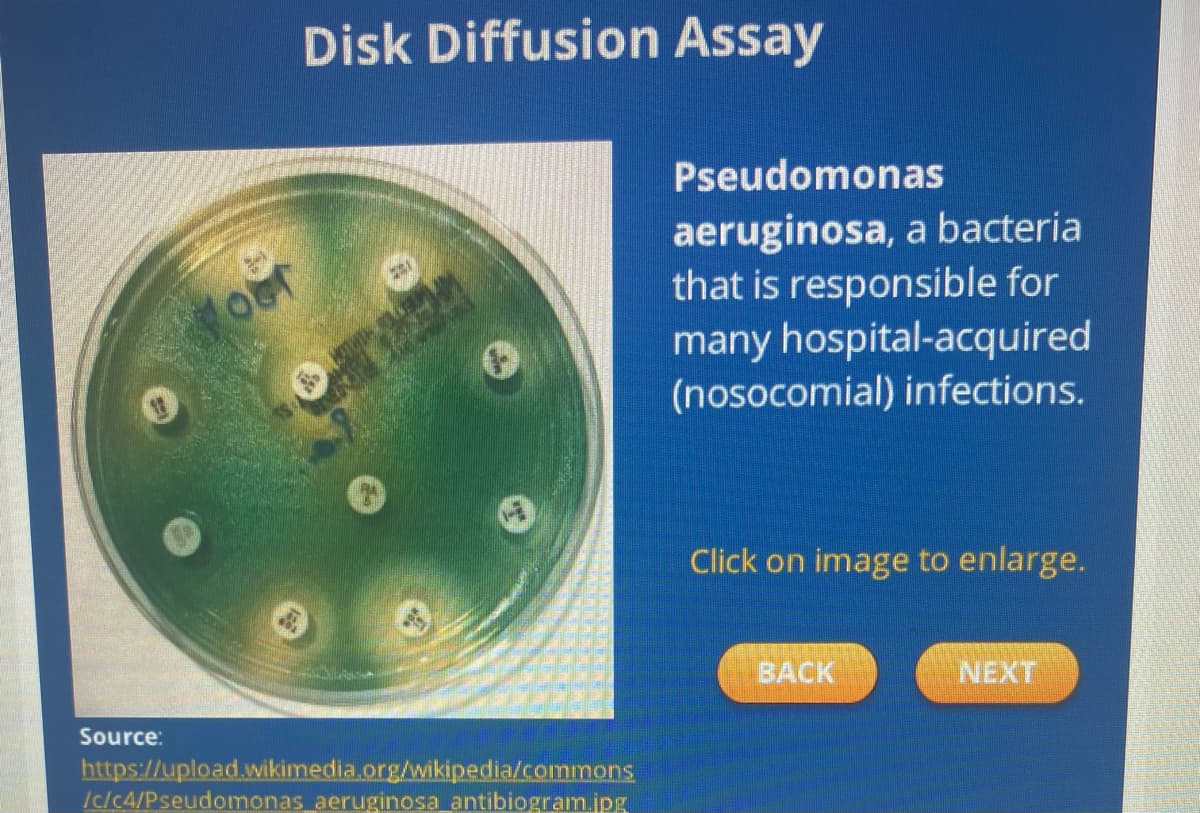 Source:
loof
Disk Diffusion Assay
ZAN
https://upload.wikimedia.org/wikipedia/commons
/c/c4/Pseudomonas aeruginosa antibiogram.jpg
Pseudomonas
aeruginosa, a bacteria
that is responsible for
many hospital-acquired
(nosocomial) infections.
Click on image to enlarge.
BACK
NEXT