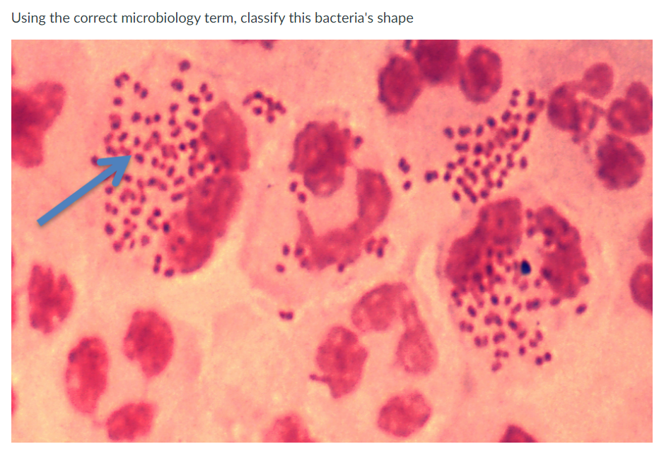 Using the correct microbiology term, classify this bacteria's shape