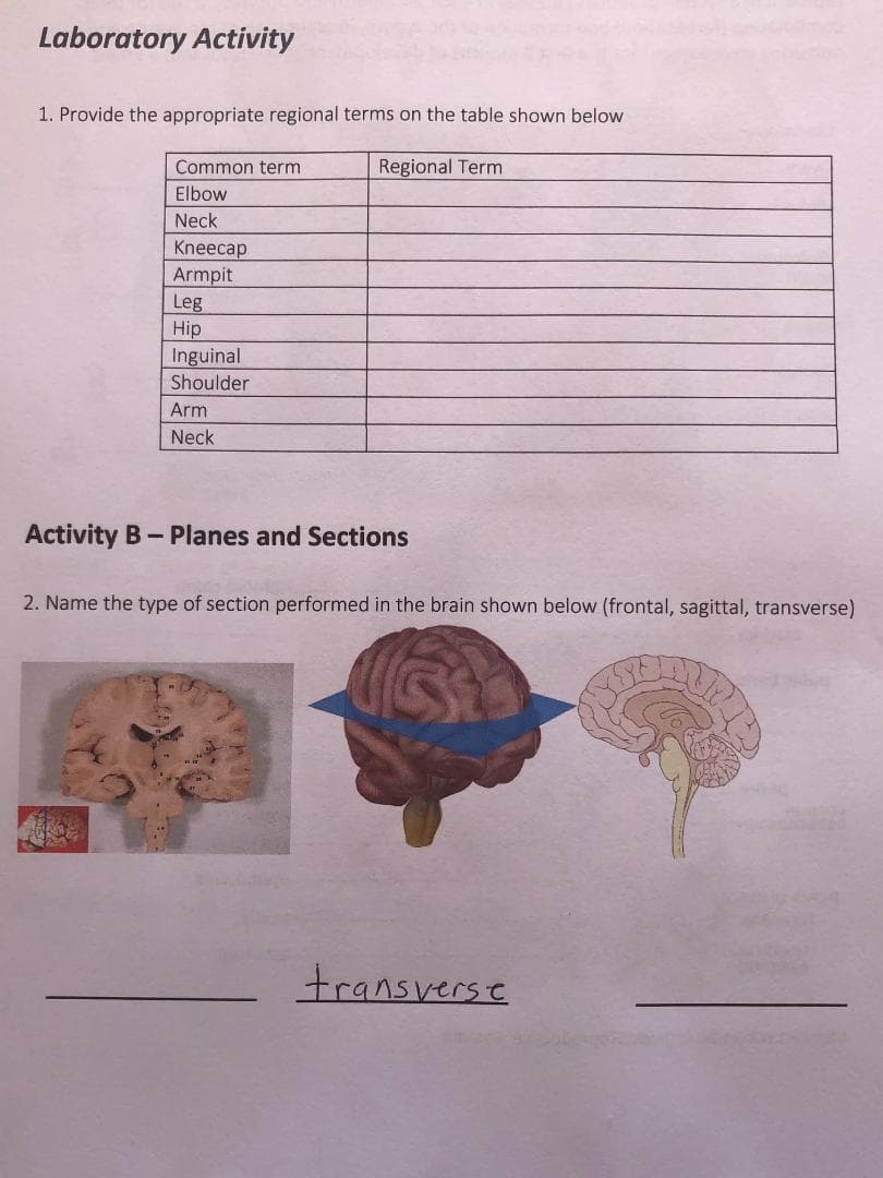 Laboratory Activity
1. Provide the appropriate regional terms on the table shown below
Common term
Regional Term
Elbow
Neck
Kneecap
Armpit
Leg
Hip
Inguinal
Shoulder
Arm
Neck
Activity B-Planes and Sections
2. Name the type of section performed in the brain shown below (frontal, sagittal, transverse)
transverse
