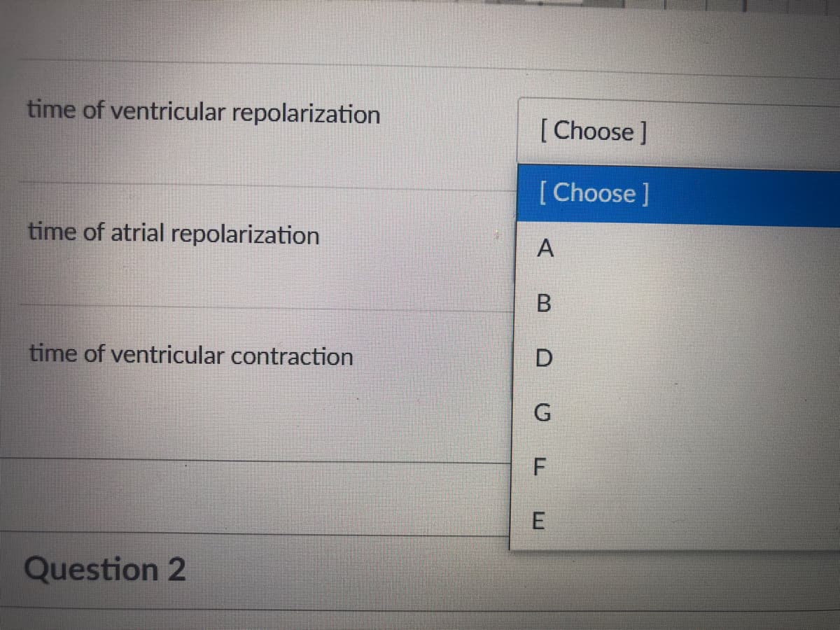 time of ventricular repolarization
[Choose ]
[Choose ]
time of atrial repolarization
B.
time of ventricular contraction
F
Question 2
E.
