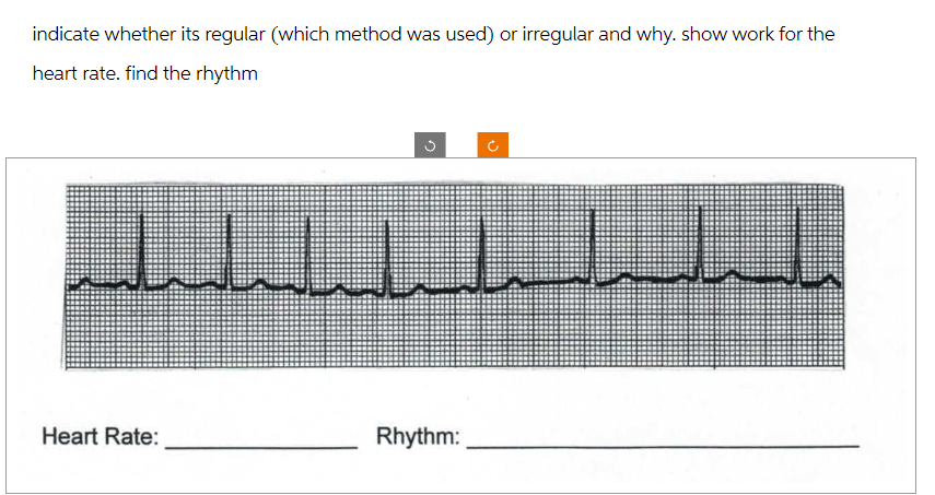 indicate whether its regular (which method was used) or irregular and why. show work for the
heart rate. find the rhythm
Heart Rate:
n
Rhythm: