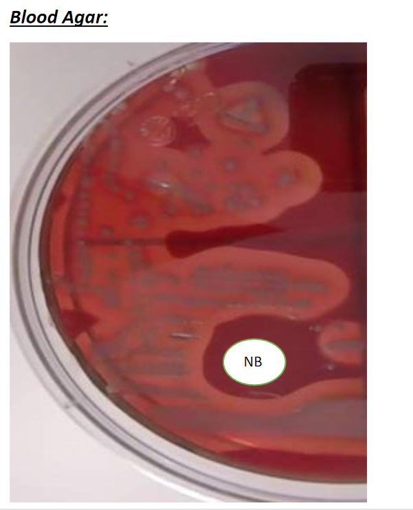 Blood Agar:
NB
