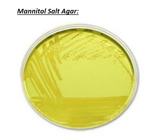 Mannitol Salt Agar:
